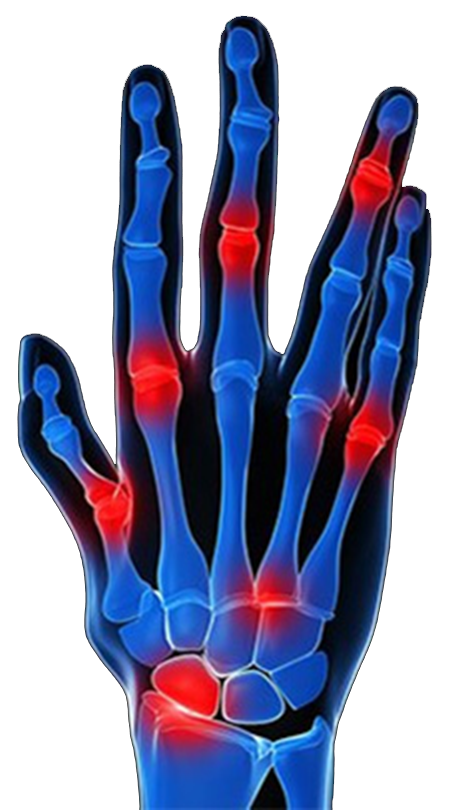 The Hidden Dangers Of Periodontal Disease