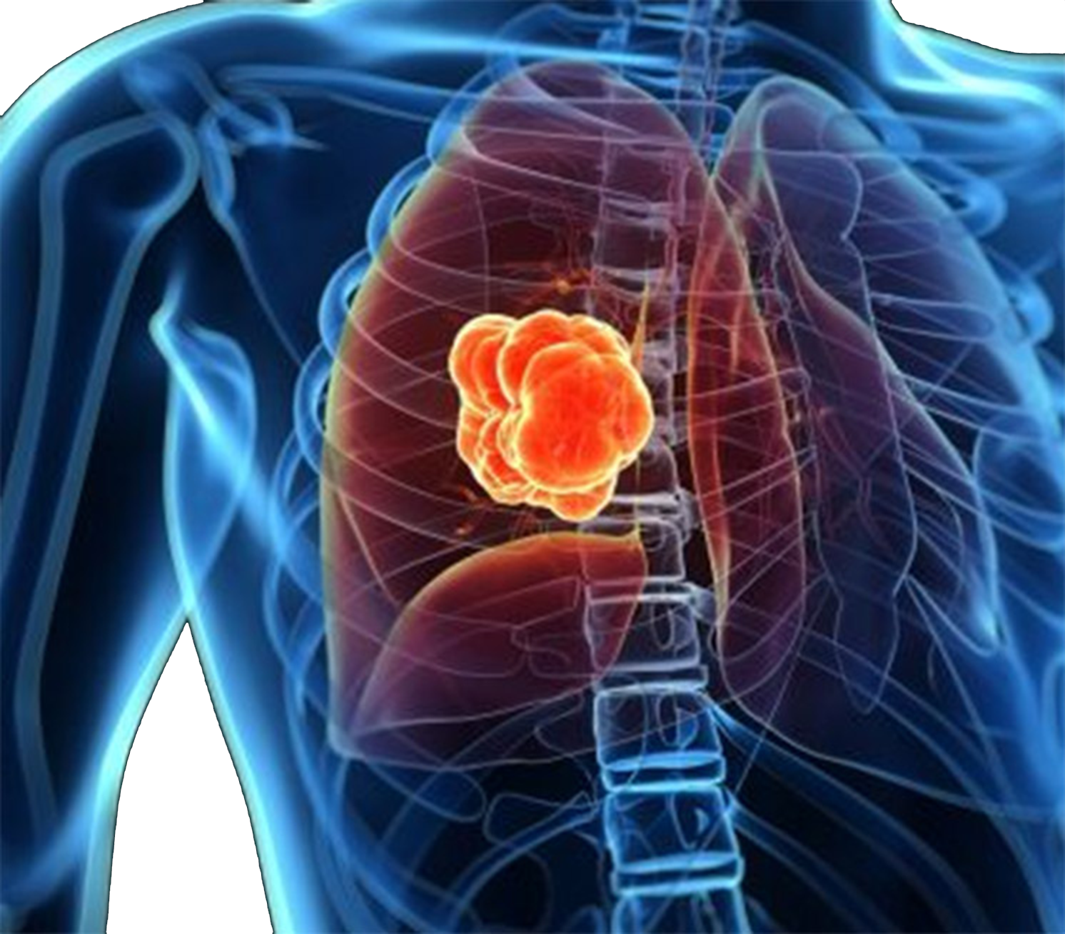 The Hidden Dangers Of Periodontal Disease