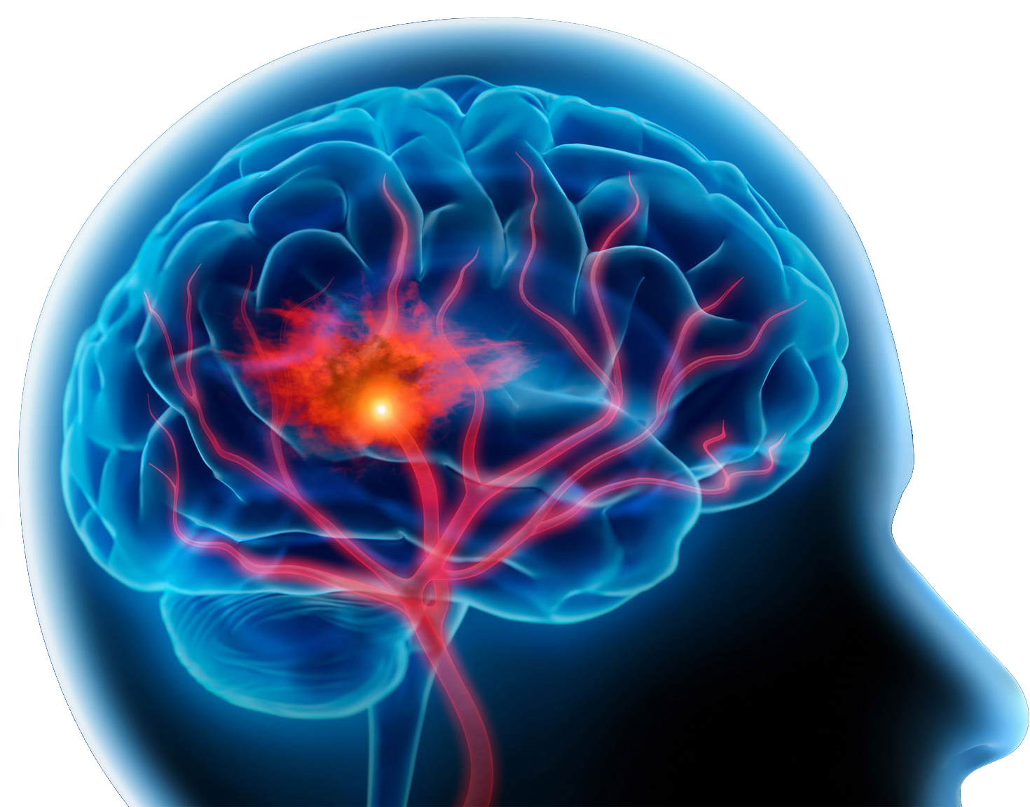 The Hidden Dangers Of Periodontal Disease