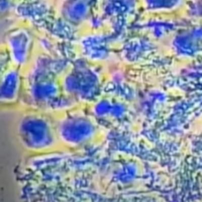 White Blood Cells
